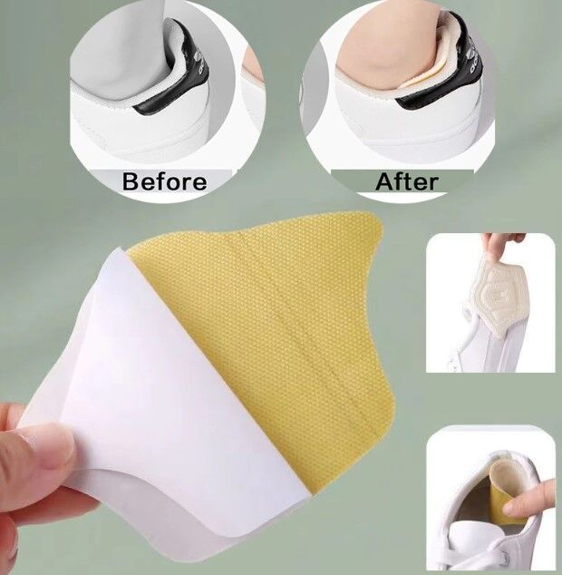 Taç Şeklinde Topuk Vurma Önleyici 10 mm.